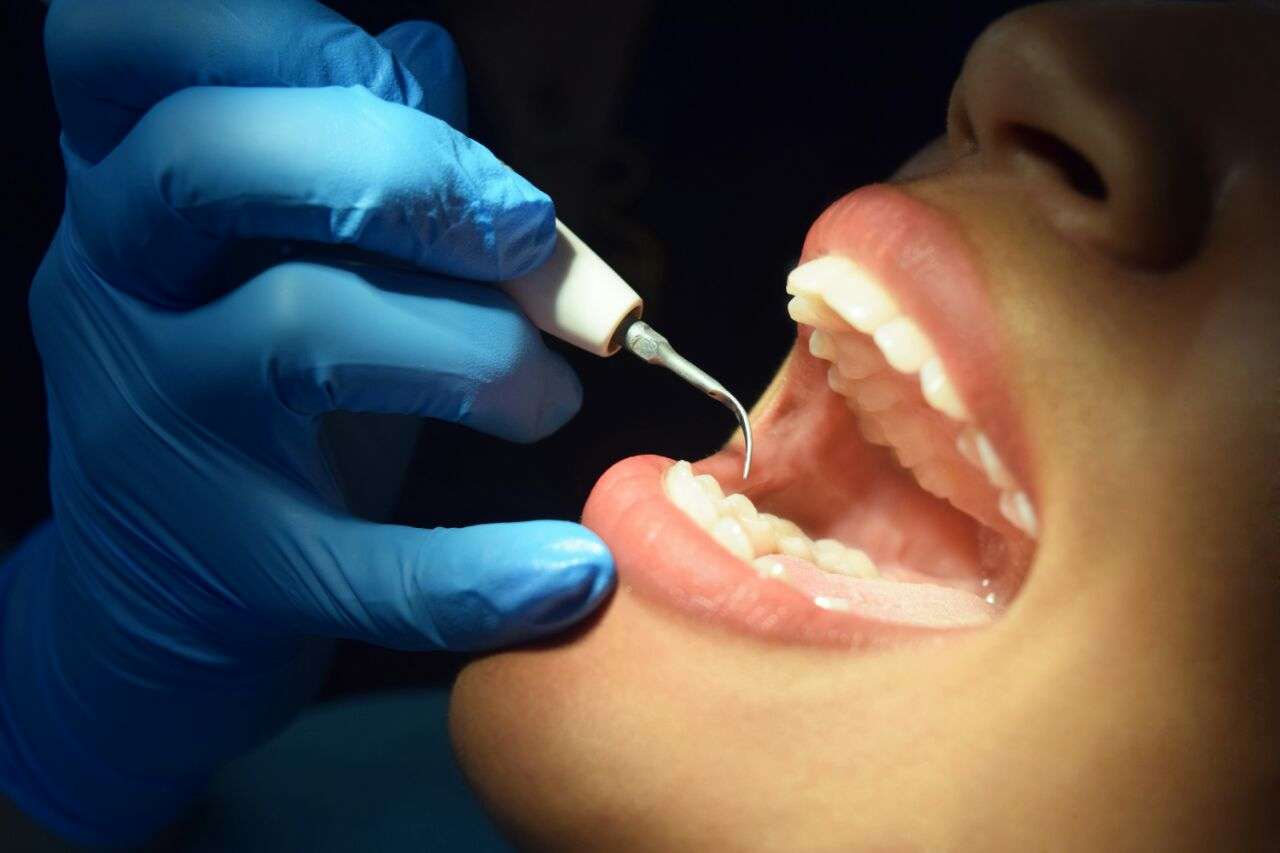 Implantes